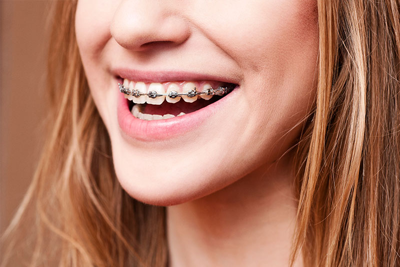 Orthodontics in Friendswood
